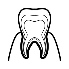 歯茎と歯の神経