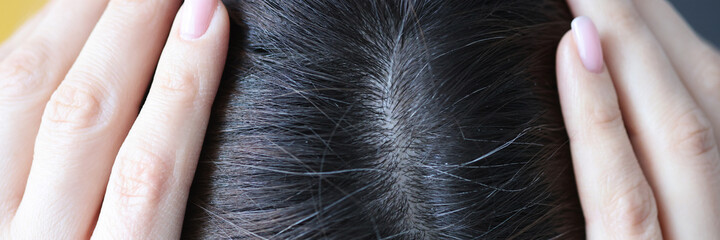 Closeup of gray hair on woman head