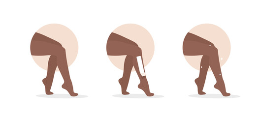 Hair removal. Waxing or sugaring process with strips. African female legs. Skin care. Before and after. Step by step procedure of epilation. Beauty salon. Vector illustration in flat cartoon style.