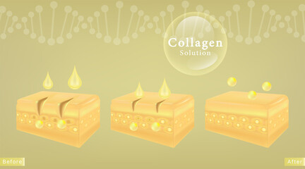 Hyaluronic acid before and after skin solutions ad, yellow collagen serum drops with cosmetic advertising background ready to use, illustration vector.