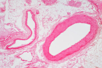 Artery vascular cross section under the light microscope view .