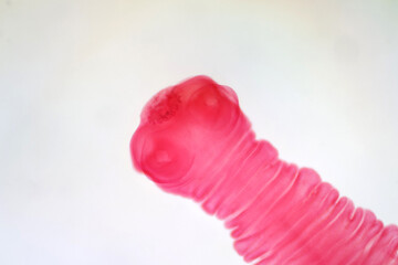 Tapeworm (Parasitic flatworm).