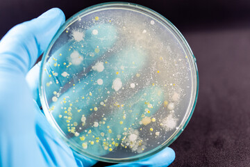 Backgrounds of Characteristics and Different shaped Colony of Bacteria and Mold growing on agar...