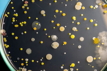 Backgrounds of Characteristics and Different shaped Colony of Bacteria and Mold growing on agar plates from Soil samples for education in Microbiology laboratory.
