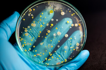 Backgrounds of Characteristics and Different shaped Colony of Bacteria and Mold growing on agar...