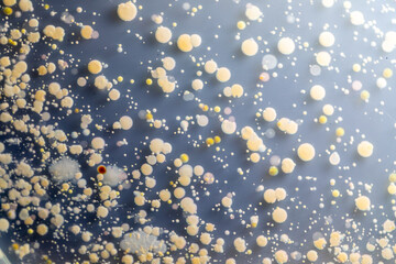 Backgrounds of Characteristics and Different shaped Colony of Bacteria and Mold growing on agar...