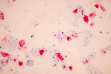 Characteristics of anatomy and Histological sample Squamous epithelial cells under microscope,...