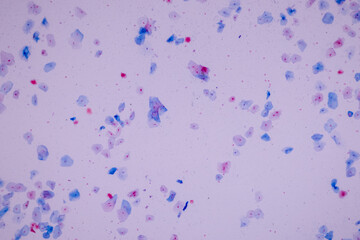 Characteristics of anatomy and Histological sample Squamous epithelial cells under microscope, Human and isolated Cell.
