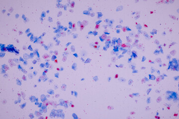 Characteristics of anatomy and Histological sample Squamous epithelial cells under microscope, Human and isolated Cell.
