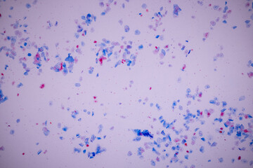 Characteristics of anatomy and Histological sample Squamous epithelial cells under microscope, Human and isolated Cell.
