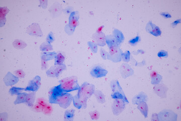 Characteristics of anatomy and Histological sample Squamous epithelial cells under microscope, Human and isolated Cell.
