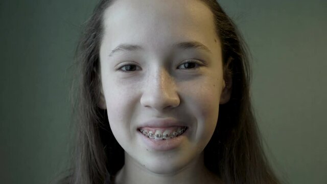 A sad young teenage girl looks at the camera, then starts to smile and shows her teeth with metal braces. Close-up of the face. Concept. 4K.