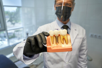 Skilled medical doctor providing visual aid of a dental implant
