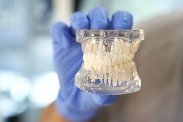 Replica of human jaws in hand of a dentist