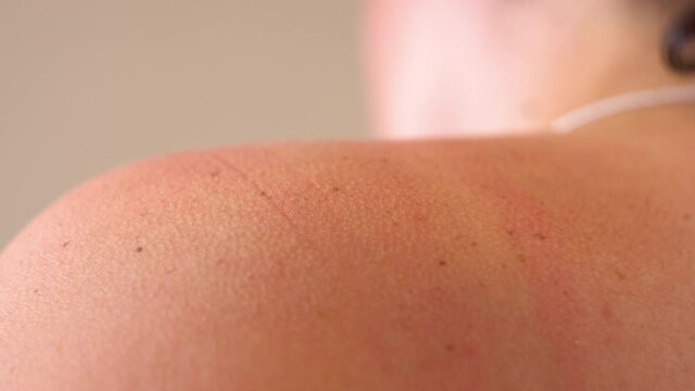 An adult woman straightens her bra strap. Underwear. Woman's shoulder. Manicure on the hand. Plump body. Buying linen. Fitting. Change of clothes. Romantic date. Part of the body. Close-up.