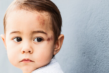 Baby mit Gesichtsverletzungen