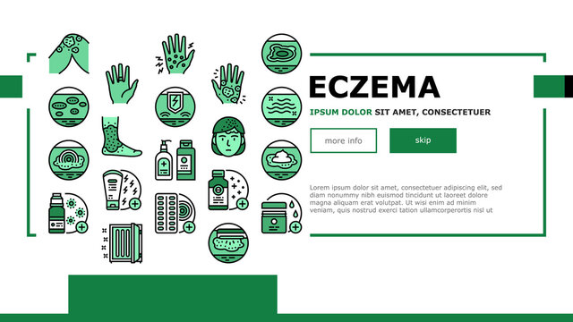 Eczema Disease Treat Landing Header Vector. Nummular And Neurodermatitis Eczema Treatment, Dry Skin And Pain, Contact And Atopic Dermatitis. Illustration