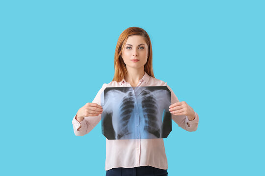 Woman with x-ray image of lungs on color background