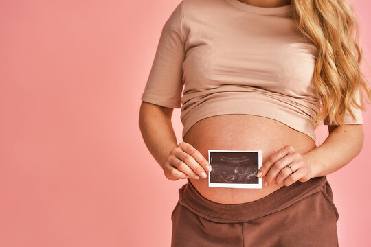 pregnant woman holding an ultrasound image of her newborn newborn baby, near her stomach, standing on a pink background. Close-up. Happy pregnancy, waiting for the baby. Copy space