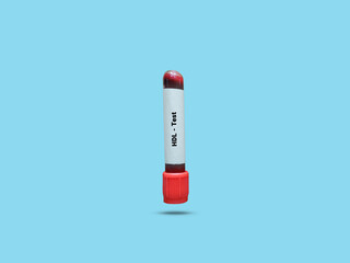 Test Tube with blood sample for HDL (High-density lipoprotein) test. Lipid profile. Good Cholesterol. A medical testing concept in the blue background.