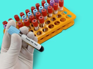 Biochemist or Lab Technologist holds Blood sample for factor VIII or anti-hemophilic factor,...