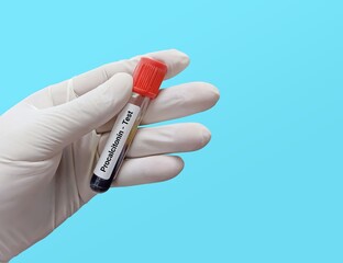 Biochemist or Doctor holds Blood sample for Procalcitonin (PCT) test, diagnosis of severe sepsis test. Medical testing concept. - obrazy, fototapety, plakaty