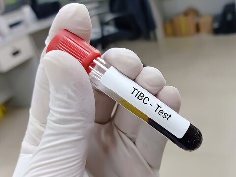 Biochemist or Lab Technologist holds Blood sample for Total Iron Binding Capacity , TIBC test. Iron deficiency anemia, Transferrin. Medical testing concept.