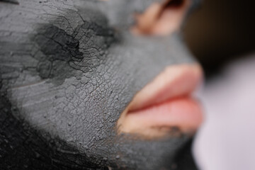 Close-up of a face covered with a clay mask. Mud spa. The texture is dry with cracks. Dehydrated skin. Anti-acne purifying mask. Personal care. Health care