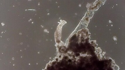 A microscopic rotifer filter feeds and retracts its body.