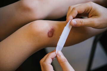 A man's hand sticks a Band-Aid on the damaged skin on the child's leg.An abrasion and a scratch on...