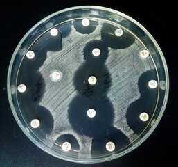 Antimicrobial susceptibility testing in petri dish. Antibiotic resistance of bacteria