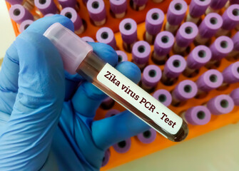 Blood sample for Zika virus PCR test