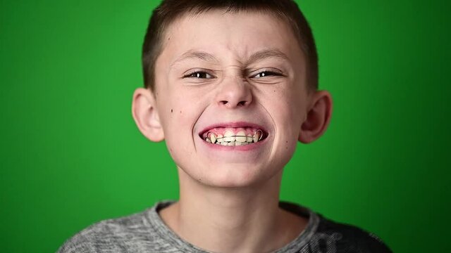 Smile baby, boy wears a plate for aligning teeth, dental care.