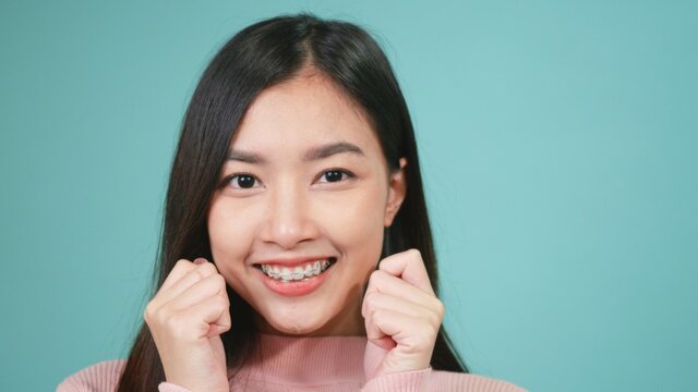 Portrait young Asian beautiful woman smiling wear silicone orthodontic retainers on teeth isolated on blue background, Teeth retaining tools after removable braces. Dental hygiene and health concept