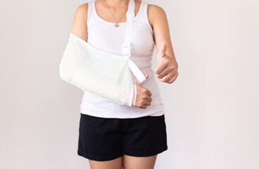 Patient woman wearing arm sling and showing thump up for relieve broken arms on white...