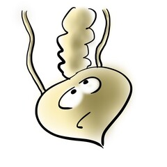 Bladder and dilated accessory ureter