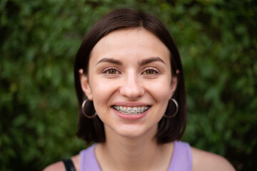Young girl smiling with metal dental braces on teeth - obrazy, fototapety, plakaty