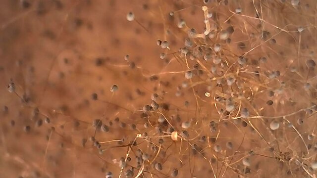 Microscope Mold Sporangium and Sporangiospore 500x Biology Fungi