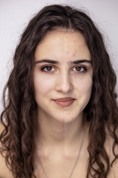 Before and after face skin photo of a young, beautiful brunette girl