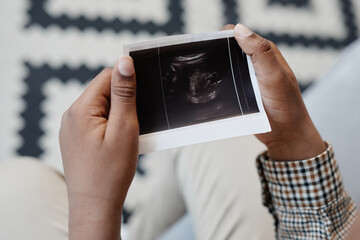 Close up of unrecognizable boy holding baby X ray picture, copy space