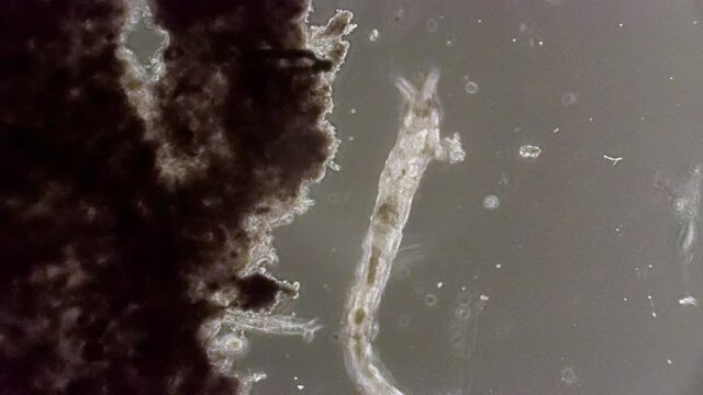A microscopic animal crawls up and out of frame.
