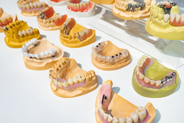 Various models prosthesis. Demonstration dentures jaws. Jaws with various diseases. Dental...