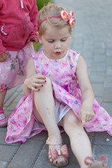 Sore, knee smashed, child complains of pain in knee