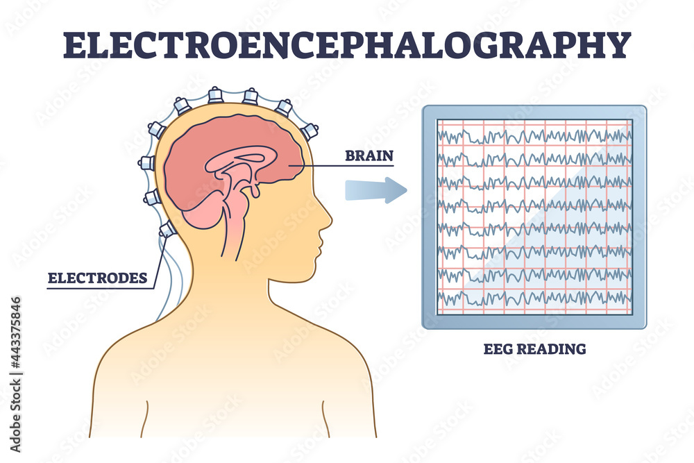 Poster electroencephalography or eeg as brain activity monitoring outline diagram. medical health examinati
