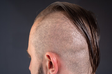 Obraz premium Close up male haircut. Hairstylist bold head. Barbershop concept. Man barber hairstylist.