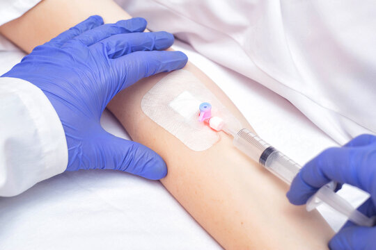 The doctor injects the medicine from a syringe into the female patient's venous catheter. Pain reliever and anti-inflammatory agent, vasodilator
