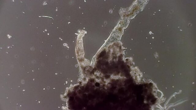 A microscopic rotifer filters pond water for food.