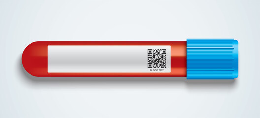 Blood test glass tube with a blank information label. © Topuria Design