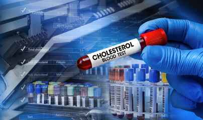 Blood sample tube for cholesterol analysis tests in lab. Technician holding tube labeled...