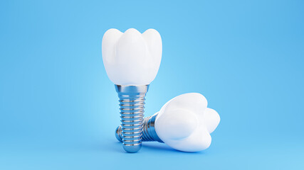 dental implant on blue background - obrazy, fototapety, plakaty